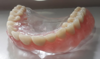 Prótese dentaria