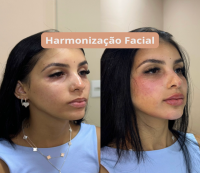 Dra. Daniele Cristina | Botox e Harmonização Facial em Monte